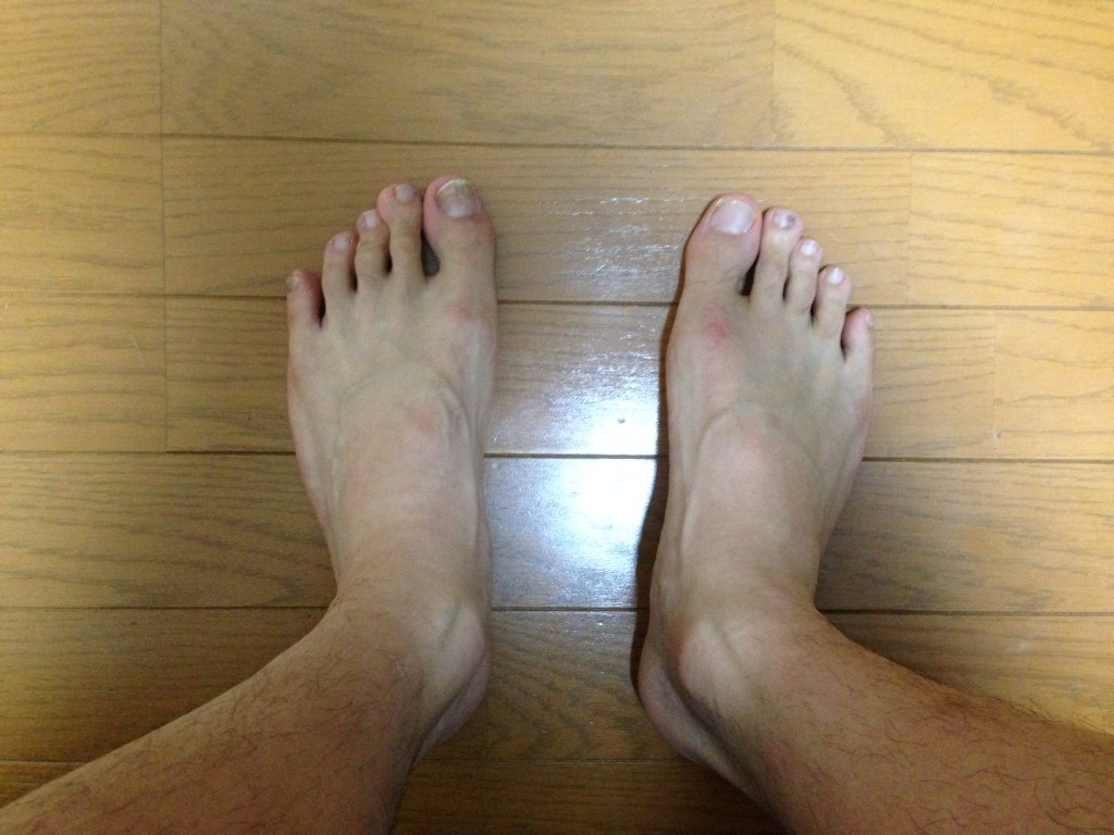 foot_after_shounan_marathon